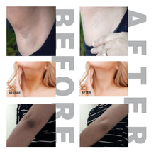 Load image into Gallery viewer, BELA DIVO Dark Spot Cream - Natural Underarm & Intimate Cream - Dark Spot Corrector - for Face and Sensitive Skin, Armpit, Knees, Elbows - for Hyperpigmentation and Even Skin Tone - Alpha Arbutin, Niacinamide (1.7OZ/50ML)